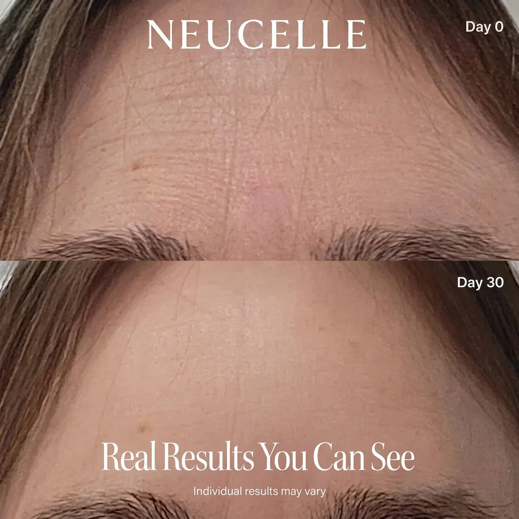 LED Cell Renewal Mask