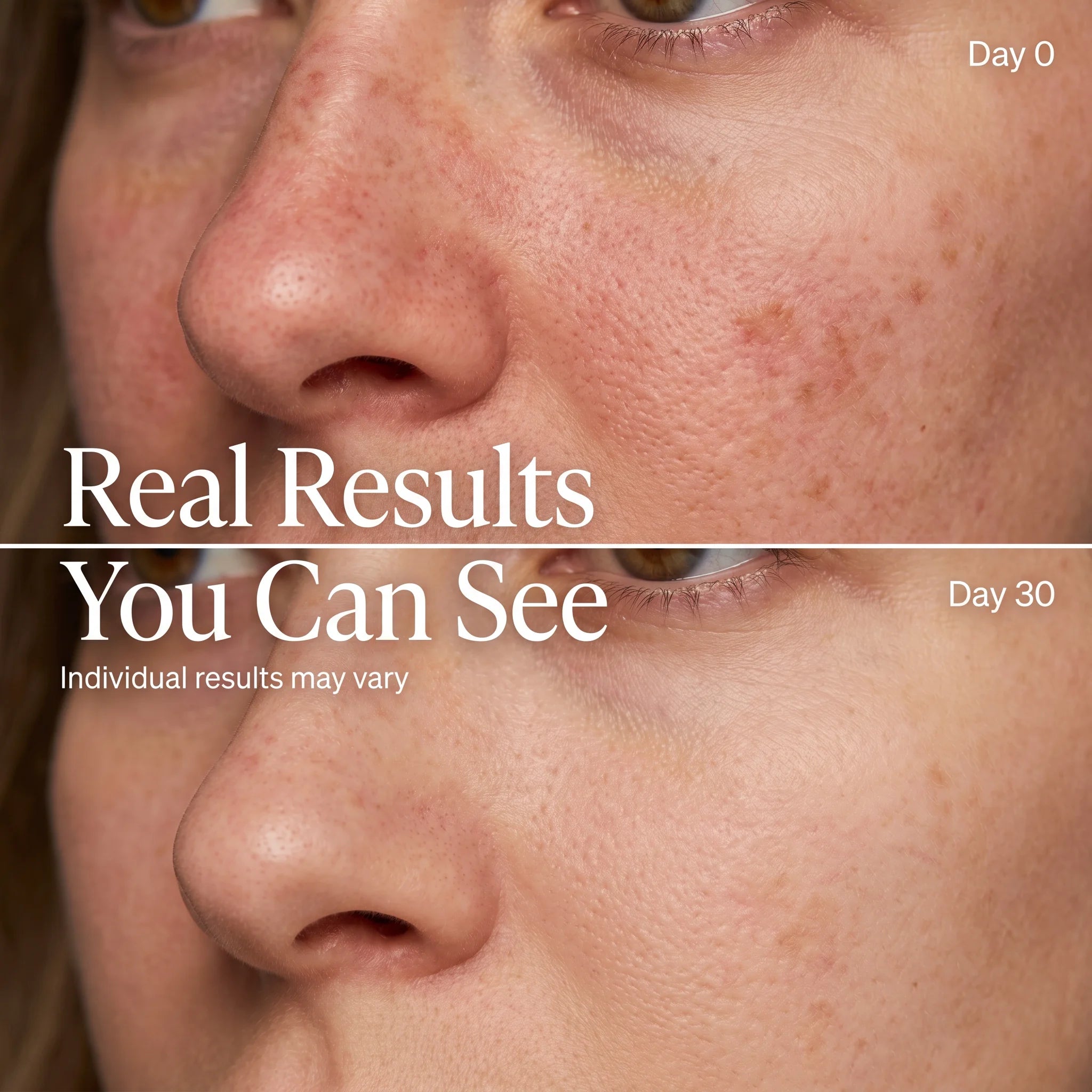 LED Cell Renewal Mask